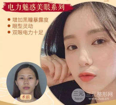 開(kāi)眼角疤痕怎么形成