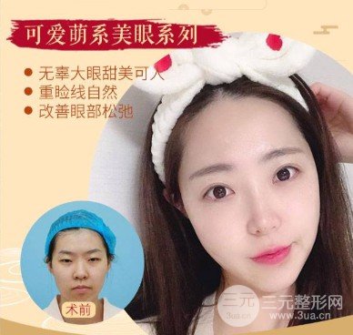 開(kāi)眼角疤痕怎么形成