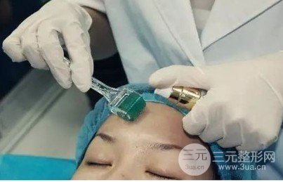 微針美容的大概費(fèi)用