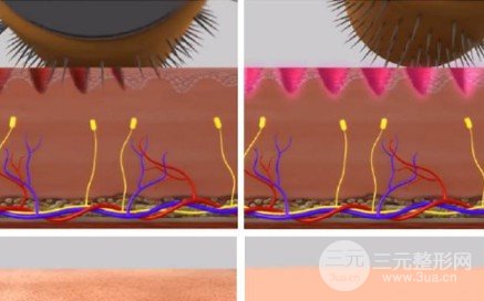 微針美容的大概費(fèi)用