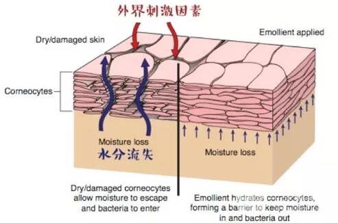 來了！你的敏感皮膚“自救”指南
