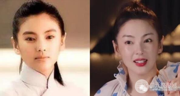 姐姐抗衰方法大揭密|激光+注射，緊膚塑形有道理！