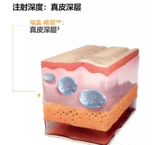 交聯(lián)的小顆粒玻尿酸可以應(yīng)用于水光補水嗎?