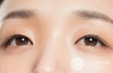 做雙眼皮手術(shù)恢復(fù)時(shí)間