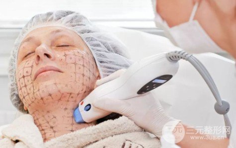 做熱瑪吉有什么后遺癥