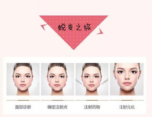 注射注射瘦臉后的護(hù)理方法