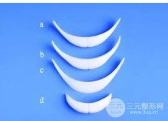 墊下巴手術(shù)價(jià)格多少？下巴短后縮能墊下巴嗎?