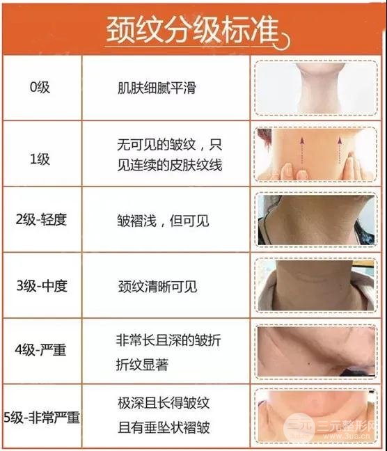 頸紋嚴重程度