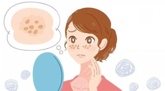 去除黃褐斑方法