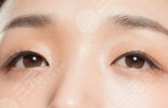 割雙眼皮修復(fù)多少錢？同院還要收錢嗎？