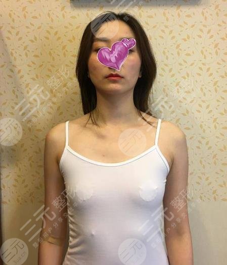 林沸騰醫(yī)生隆胸圖片