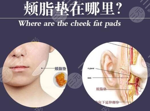 頰脂墊位置