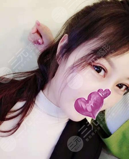 遵義醫(yī)學(xué)院附屬醫(yī)院整形祛斑案例