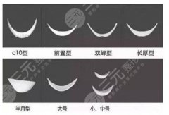 做下巴假體幾天能恢復(fù)好？會影響神經(jīng)嗎？附切口圖