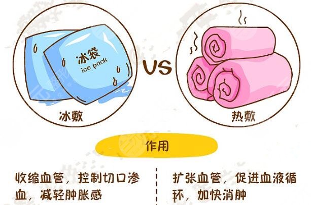 雙眼皮全切術(shù)后如何快速消腫