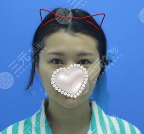 火鳳凰溶脂有果嗎