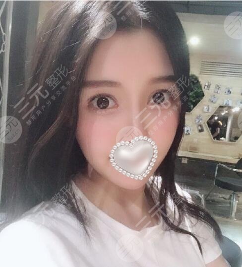 火鳳凰溶脂有果嗎