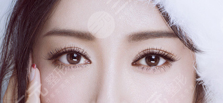 全切雙眼皮多少錢