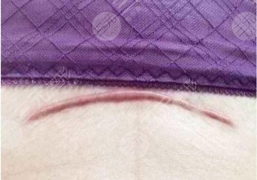 濟南歐洲之星點陣激光的作用