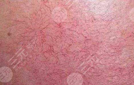 濟南歐洲之星點陣激光果