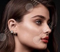 假體隆下巴一般多少錢？多久恢復(fù)自然？V臉秘籍點(diǎn)擊一覽！