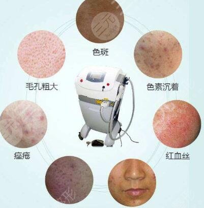 濟南歐洲之星點陣激光的優(yōu)勢