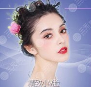 打玻尿酸墊下巴能維持多久？要注意什么？絕美側(cè)臉就靠ta，必看攻略！