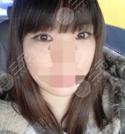 手術(shù)后3個半月