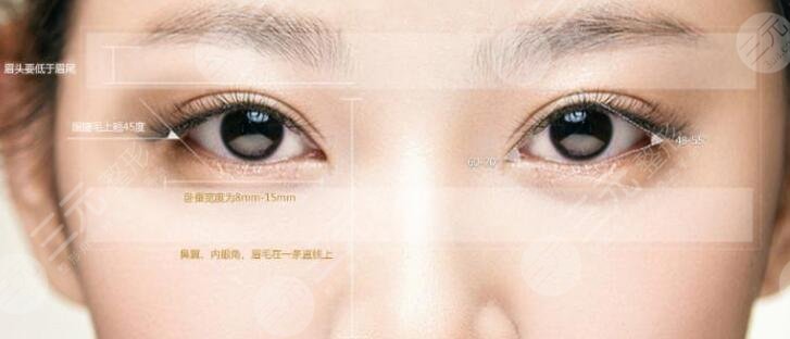 雙眼皮翹睫術(shù)是什么？