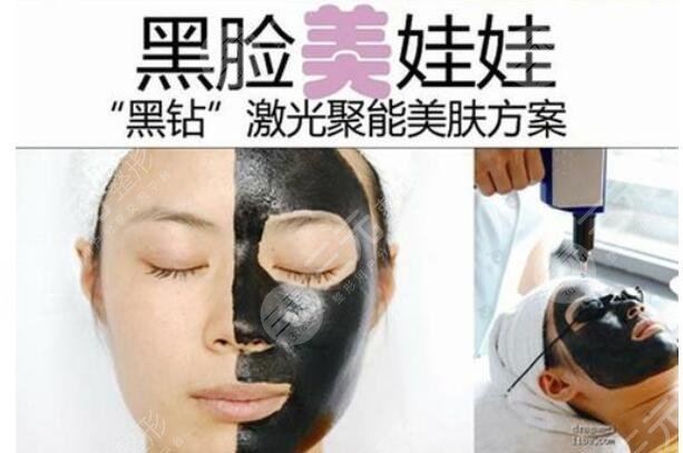 什么是黑臉娃娃？