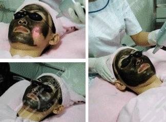 黑臉娃娃嫩膚果、危害