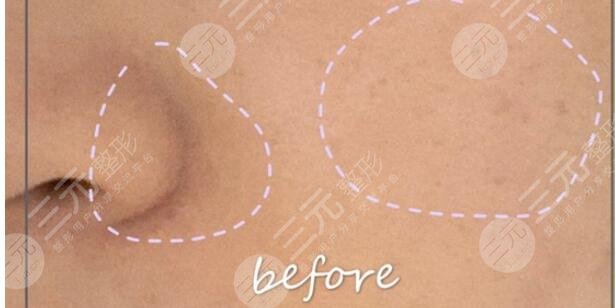 黑臉娃娃果參考