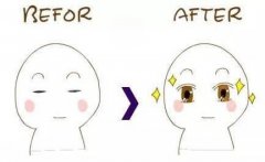 雙眼皮全切過程是怎樣的？雙眼皮全切過程步驟解析！