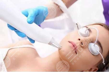 光子嫩膚后的術(shù)后護(hù)理