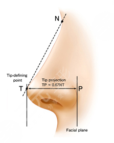 隆鼻整容手術(shù)