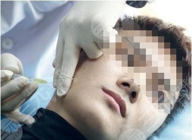 男生打注射瘦臉