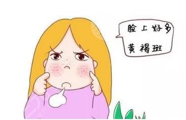 什么是激光去除黃褐斑