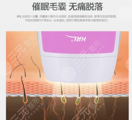 光子除毛成好嗎