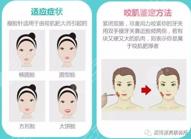 注射瘦臉適合人群