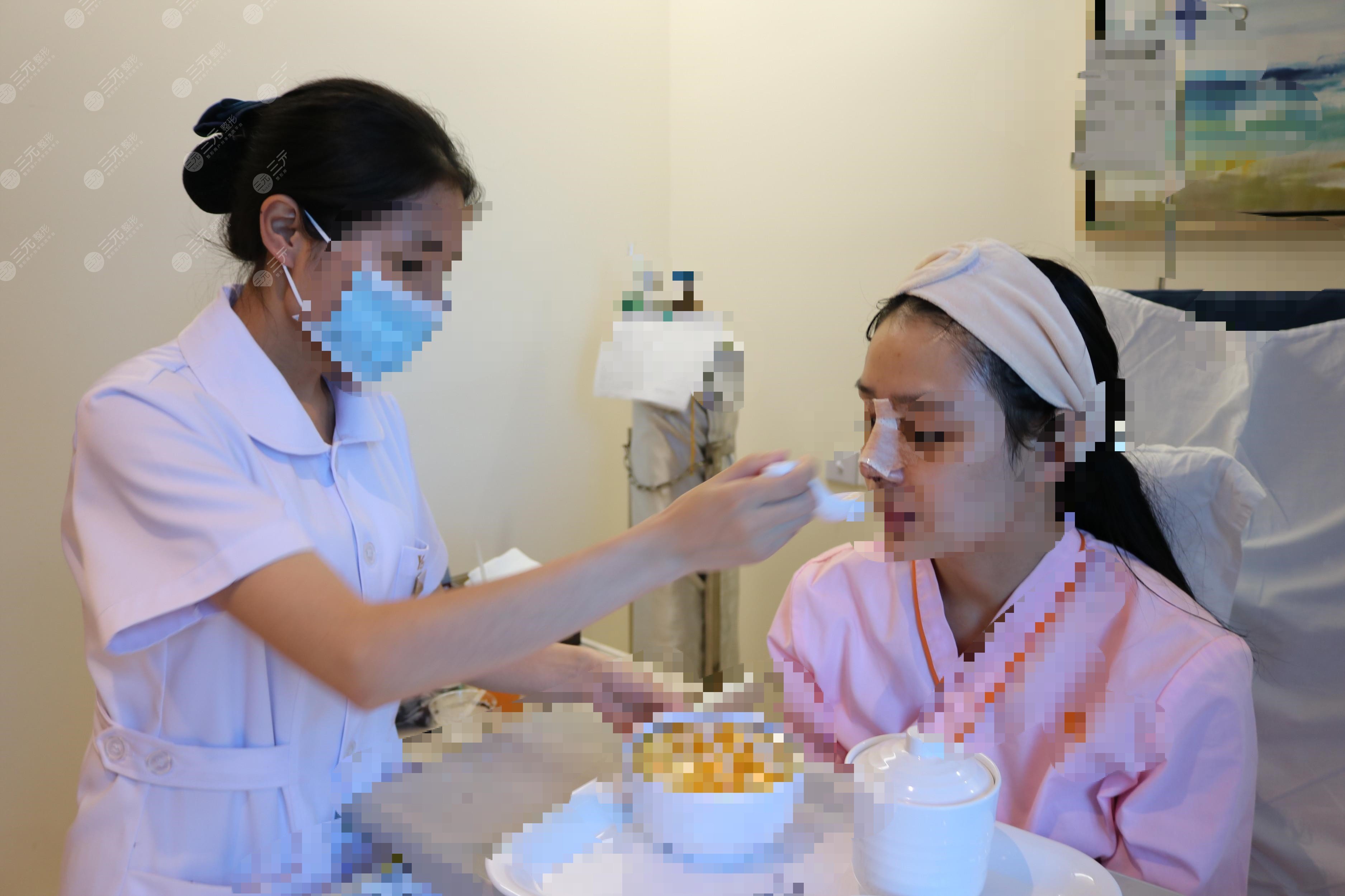 隆鼻前后對比果圖片