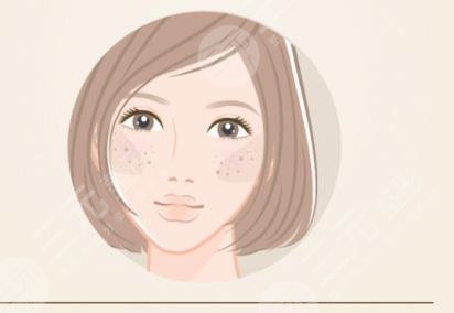 激光祛黃褐斑反多久可以恢復(fù)