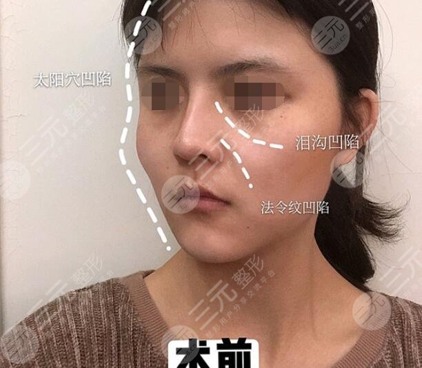 徐懷河醫(yī)生真人案例參考前