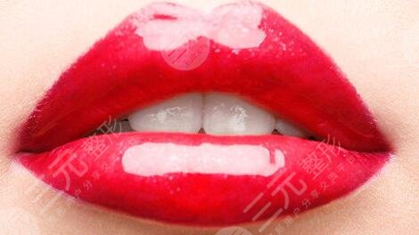 非手術豐唇方法有哪些？微創(chuàng)豐唇方法大全~