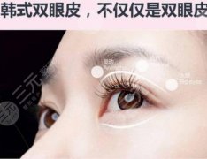 韓式微創(chuàng)雙眼皮可以保持多少年？韓式微創(chuàng)雙眼皮的優(yōu)勢