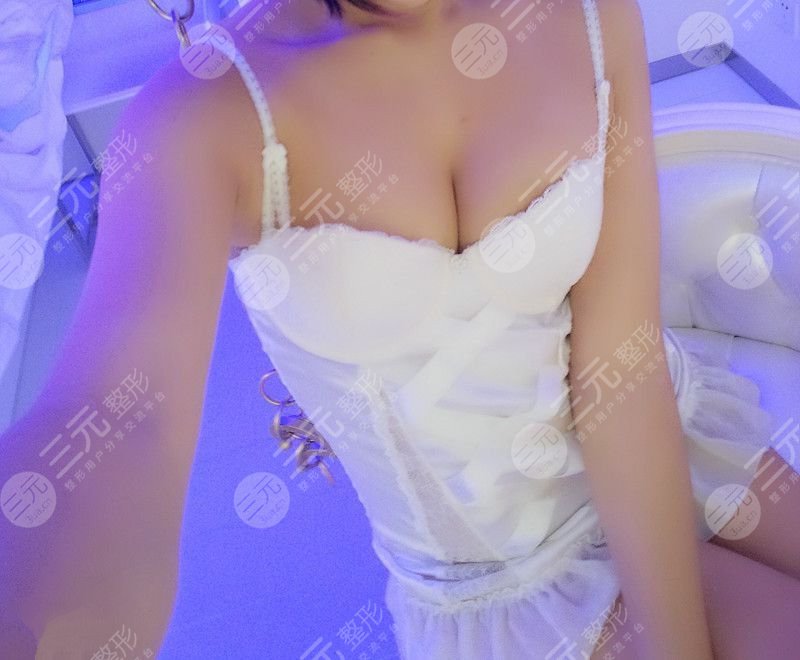 乳房縮小術(shù)前后對(duì)比,看了你就相信杭州美來(lái)比較好!