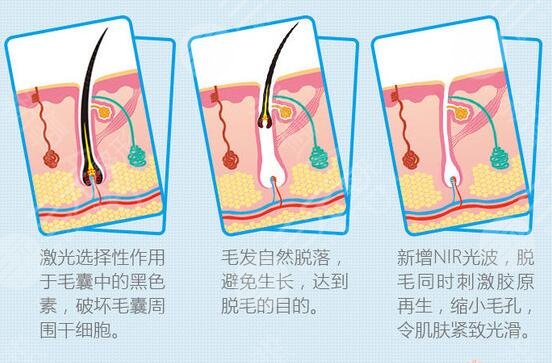 女人唇部脫毛有哪些方法？3種有辦法讓你擺脫難堪！