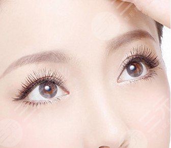 開眼角多久可以重新修復(fù)，帶你詳細(xì)了解開眼角手術(shù)