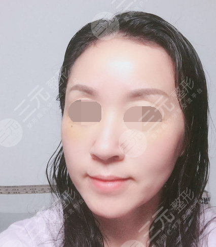 面部年輕化plus全臉，快速解決面部問題，內(nèi)附真實(shí)案例分享圖