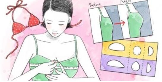 北京假體隆胸真人案例大分享,豐胸果看得見(jiàn)