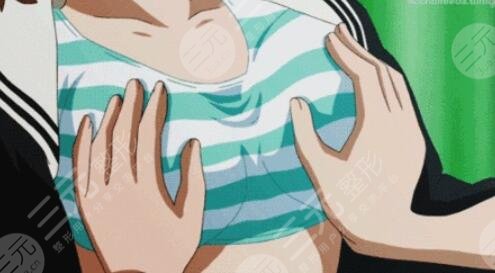 重慶自體脂肪隆胸，1個半月后的果